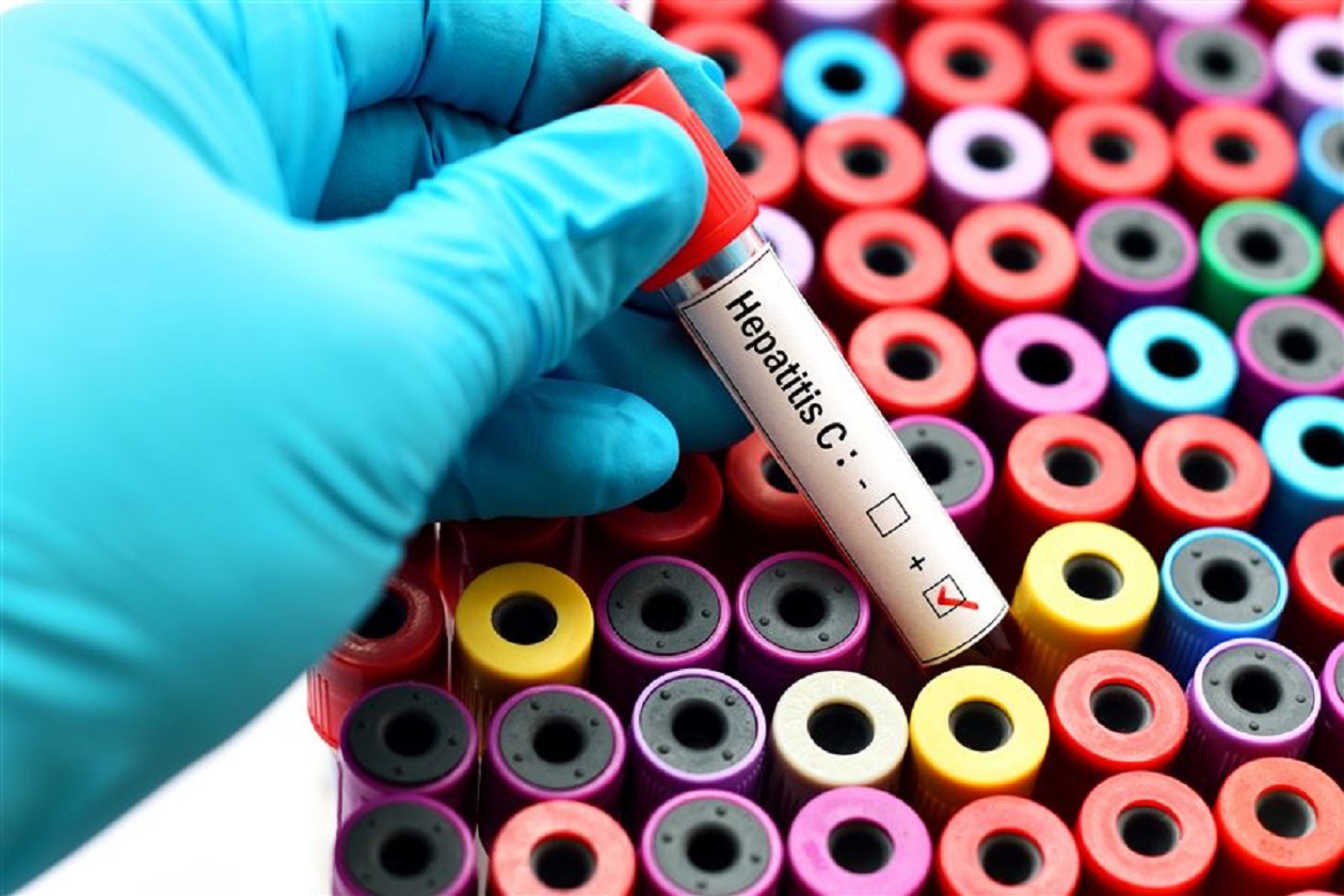 Epatite C, al via il piano per eradicare il virus in Puglia